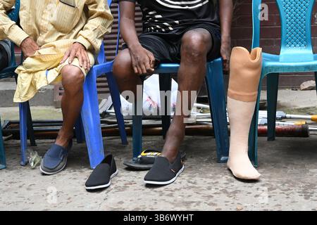 Persone con le loro gambe protesiche artificiali montate durante il campo di allenamento degli arti artificiali a Dacca, Bangladesh, il 4 maggio 2025. Attraverso l'iniziativa Easy Life for Bangladesh e Swapna Neer, 25 paraplegici sono stati dotati gratuitamente di gambe protesiche. Crediti: Mamunur Rashid/Alamy Live News Foto Stock