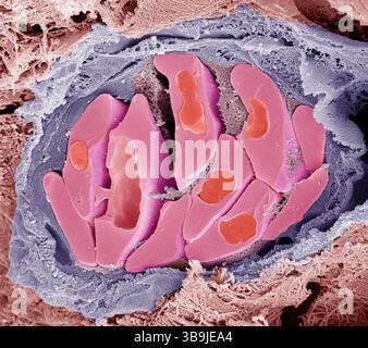 Eritrociti di uccelli. Micrografia elettronica a scansione colorata (SEM) di globuli rossi fratturati (eritrociti, rossi) dai vasi sanguigni aviari. Queste cellule contengono emoglobina, un pigmento che permette loro di trasportare ossigeno in tutto il corpo. I globuli rossi non mammiferi (come questi) sono di forma ovale (discoide) e contengono un nucleo cellulare. Gli eritrociti umani sono a forma di disco e non hanno un nucleo cellulare. La fibrina (utilizzata nella coagulazione del sangue) può essere osservata tra le cellule. Il tessuto connettivo circonda il vaso sanguigno. Ingrandimento: x4000 se stampato largo 10 centimetri. Foto Stock