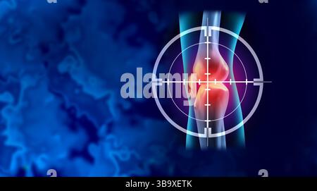Targeting dolore al ginocchio e sollievo dal dolore per l'infiammazione articolare come condizione medica della gamba come un simbolo ortopedico o la diagnosi di artrite. Foto Stock