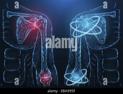 Illustrazione vettoriale poligonale di un'articolazione umana infiammata della spalla e del gomito malata e recupero della funzione della spalla e del gomito. Banner medico, templ Foto Stock