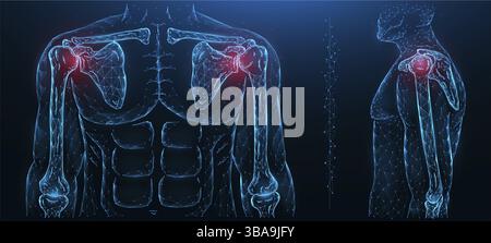 Illustrazione vettoriale poligonale di un'articolazione dolorosa della spalla. Malattia delle articolazioni della spalla. Malattie del sistema muscoloscheletrico umano Foto Stock