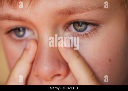 Ragazzo allergico che gratta gli occhi da vicino Foto Stock