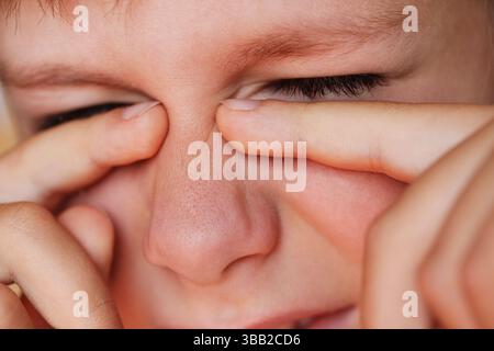 Ragazzo allergico che gratta gli occhi da vicino Foto Stock