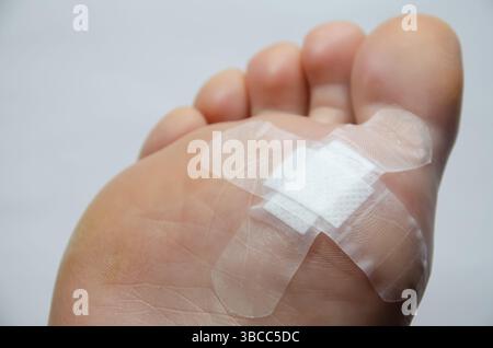 Chiudere il piede con l'intonaco dopo l'intervento chirurgico per rimuovere la verruca. Piedi feriti. La patch bianca protegge la ferita dallo sporco. Podologia: Rimozione delle verruche. Caucasi Foto Stock
