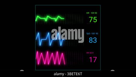 Immagine dell'elettrocardiografo su sfondo nero Foto Stock
