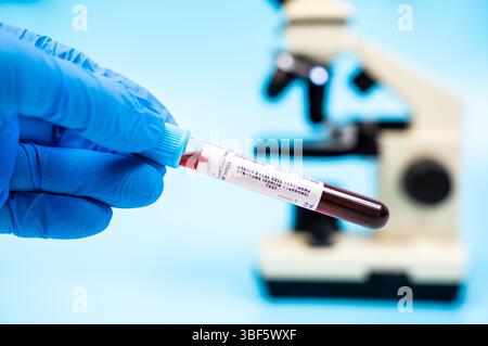 Test della sindrome da carcinoma basocellulare nevoide. Identifica le mutazioni nel gene PTCH1, causando la sindrome di Gorlin, aumentando il rischio di cancro. Analisi del sangue in laboratorio. Foto Stock