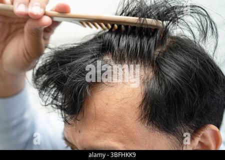 Calvo in testa e iniziare non perdita capelli glabro di maturo asiatico affari intelligente uomo di ufficio attivo. Foto Stock