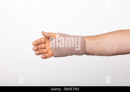La mano e il polso di un uomo avvolte in una bendatura di tessuto dopo un intervento chirurgico al tunnel carpale. Foto Stock