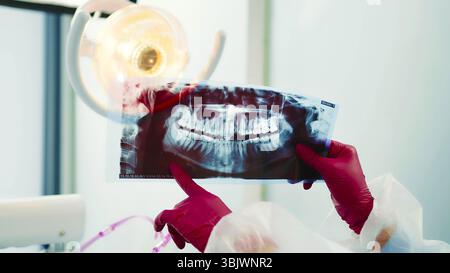 Dentista che esamina la radiografia dentale. Uno scatto ravvicinato di un dentista che regge un'immagine radiografica dentale sotto una luce intensa. Foto Stock