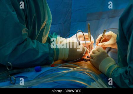 Chirurghi intensamente durante l'esecuzione di interventi chirurgici in sala operatoria dell'ospedale serio lavoro di squadra di precisione medica. Foto Stock
