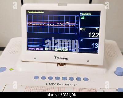 Cairo, Egitto, 17 giugno 2025: Dispositivo di cardiotocografia posizionato sull'addome della madre che registra la frequenza cardiaca fetale ottenuta tramite trasduttore a ultrasuoni, CTG Foto Stock