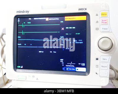 Cairo, Egitto, 17 giugno 2025: Monitor medico dei segni vitali per la misurazione di importanti segni vitali per i pazienti, come la pressione arteriosa, il ratto cardiaco Foto Stock