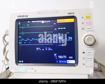 Cairo, Egitto, 17 giugno 2025: Monitor medico dei segni vitali per la misurazione di importanti segni vitali per i pazienti, come la pressione arteriosa, il ratto cardiaco Foto Stock