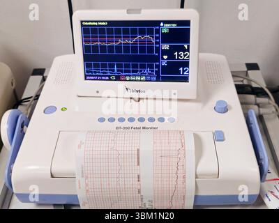 Cairo, Egitto, 17 giugno 2025: Dispositivo di cardiotocografia posizionato sull'addome della madre che registra la frequenza cardiaca fetale ottenuta tramite trasduttore a ultrasuoni, CTG Foto Stock