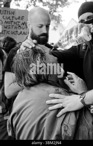 Un uomo sconosciuto dal lato antifascista della protesta UKIP riceve il primo soccorso dopo essere stato presumibilmente spruzzato al pepe dalla polizia Foto Stock