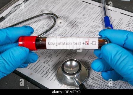 Mani con guanti che tengono in mano la provetta del campione di sangue che mostra risultati positivi del test di coagulazione, con stetoscopio e forme mediche sullo sfondo Foto Stock