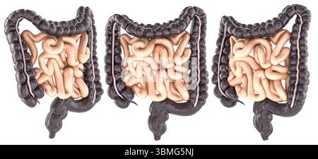 Insieme di intestini umani, tra cui intestino crasso e intestino tenue, modello anatomico 3d realistico. Vista laterale e frontale. Rendering 3D isolato su backgro bianco Foto Stock