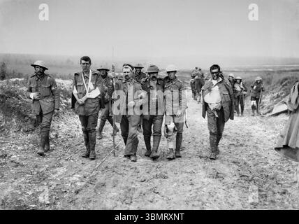 SOMME, FRANCIA - 19 luglio 1916 - Un prigioniero tedesco aiuta i feriti britannici a raggiungere una stazione di vestizione vicino a Bernafay Wood dopo i combattimenti Foto Stock