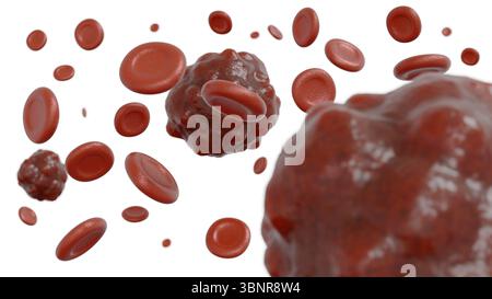 Rendering 3d di un campione di sangue contenente una formazione cancerosa, che fornisce una rappresentazione di un tumore del sangue o di una cellula maligna. Foto Stock