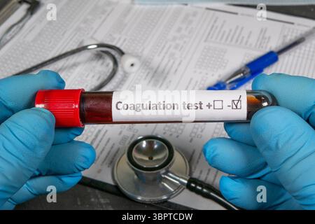 Mani con guanti che tengono in mano una provetta con campione di sangue per il test della coagulazione, con risultati positivi Foto Stock