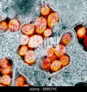 18 marzo 2020, Hamilton, Montana, USA: Questa immagine del microscopio elettronico a scansione mostra il SARS-CoV-2 (giallo) noto anche come 2019-nCoV, il virus che causa COVID-19. Il virus che causa la malattia da coronavirus può sopravvivere per giorni su alcune superfici. L'immagine è stata resa disponibile dal National Institute of Allergy and Infectious Diseases del governo degli Stati Uniti presso i suoi Rocky Mountain Laboratories in Montana ed è stata colorata digitalmente. (Immagine di credito: © NIAID-RML tramite filo ZUMA) Foto Stock