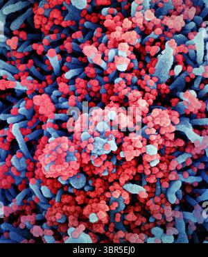 11 giugno 2020, Fort Detrick, Maryland, USA: Micrografia elettronica a scansione colorata di una cellula (blu) pesantemente infettata da particelle di virus SARS-CoV-2 (rosso), isolata da un campione di paziente. Immagine acquisita presso il NIAID Integrated Research Facility (IRF). (Immagine di credito: © NIAID via ZUMA Wire) Foto Stock