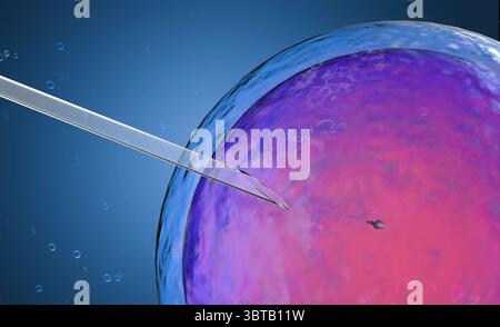 ovulo di rendering 3d con ago per inseminazione artificiale o processo di fecondazione in vitro Foto Stock