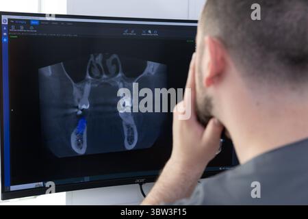 Dental Professional Analyzing 3D Cone Beam Computed Tomography Scan of Teeth and Jaw per una diagnosi accurata e una pianificazione del trattamento in odontoiatria moderna Foto Stock