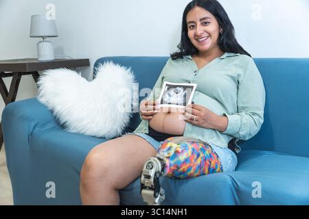 Donna incinta felice con una gamba protesica seduta su un divano, che tiene in mano una scansione ecografica del suo bambino Foto Stock
