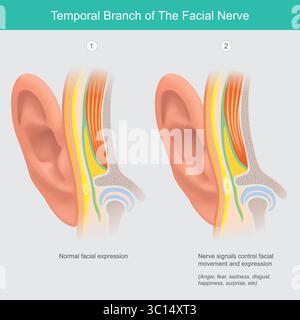 Ramo temporale del nervo facciale e dell'espressione facciale Illustrazione Vettoriale