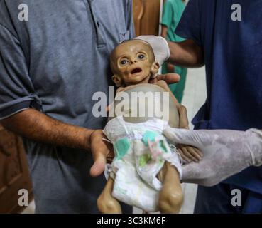 Khan Yunis, territori palestinesi. 26 luglio 2025. Un uomo ha una bambina palestinese di sei mesi Zainab Abu Haleb dopo la sua morte all'ospedale Nasser di Khan Yunis a causa di una grave malnutrizione. I bambini soffrono di malnutrizione e carestia nella Striscia di Gaza, mentre Israele continua a bloccare l'ingresso degli aiuti a Gaza. Crediti: Abed Rahim Khatib/dpa/Alamy Live News Foto Stock