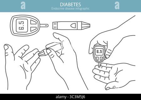Diabete. Malattie endocrine. Progettazione infografica medica. Illustrazione vettoriale Illustrazione Vettoriale