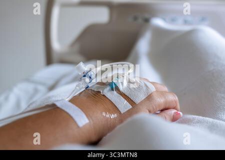Una giovane donna malata sta riposando in un letto d'ospedale a Bali, ricevendo cure. È raffigurata con un gocciolamento IV attaccato alla mano, evidenziando un ser Foto Stock
