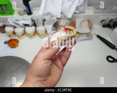protesi artificiali metallo-ceramica nelle mani di un medico Foto Stock