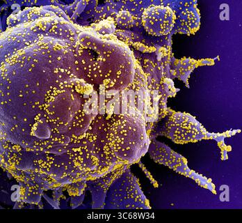 26 maggio 2020, Fredrick, Maryland, USA: Micrografia elettronica a scansione colorata di una cellula morta pesantemente infettata da particelle virali SARS-COV-2 (gialla), isolata da un campione di paziente. REMDESIVIR, un trattamento farmacologico sembra ridurre i tempi di recupero per le persone con coronavirus secondo una nuova ricerca. Il segretario sanitario britannico Hancock ha detto che probabilmente è stato il più grande passo avanti nel trattamento del coronavirus dall'inizio della crisi. Remdesivir è un farmaco antivirale che è stato usato contro l'Ebola. Ricercatori ci sono prove sufficienti per approvare il suo uso in pazienti ospedalieri Covid-19 selezionati Foto Stock