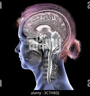 Immagine di una scansione a risonanza magnetica colorata (MRI) del cervello e del collo, che mostra l'anatomia del sistema nervoso centrale e la colonna cervicale. Foto Stock