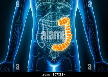 Vista radiologica anteriore o frontale del colon sinistro o distale illustrazione di rendering 3D con contorni del corpo maschile. Anatomia umana, organo dell'apparato digerente, Foto Stock