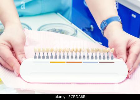 Guida ombreggiante per sbiancare i denti con mani dentiste femminili. Foto Stock