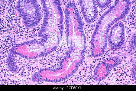 Paneth metaplasia cellulare, micrografia leggera Foto Stock