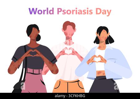 Un gruppo eterogeneo di individui con malattie della pelle sta insieme, formando una forma del cuore con le mani per aumentare la consapevolezza sulla giornata mondiale della psoriasi. V Foto Stock