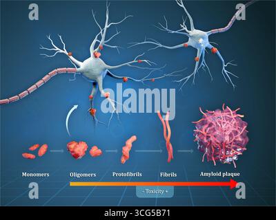 Diagramma che mostra diversi passi che portano alla formazione di placche amiloidi nella malattia di alzheimer. Illustrazione digitale, rendering 3D. Foto Stock