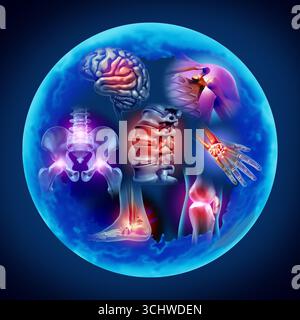 Infiammazione nel corpo infiammazioni croniche e articolazioni dolorose concetto di anatomia umana con il corpo come un gruppo di aree infiammate dolorose come un dolore A. Foto Stock