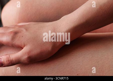 Vista dettagliata della piccola Mola scura sulla pelle liscia del braccio umano con illuminazione soffusa per interni Foto Stock