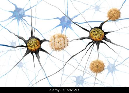 I grovigli amiloidi Beta e Tau si intendono come ammassi anomali di frammenti proteici che si accumulano tra le cellule nervose e all'interno delle cellule neuroniche nel brai Foto Stock