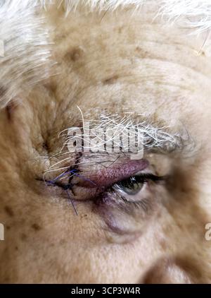 Salta e taglia all'occhio, punti Foto Stock