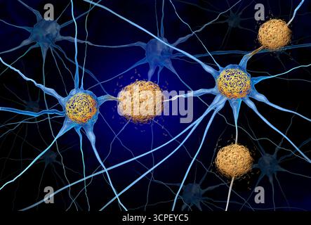 Tau Tangles e Amyloid Beta concetto come ammassi anomali di frammenti proteici che si accumulano tra le cellule nervose e all'interno delle cellule neuroniche nel brai Foto Stock