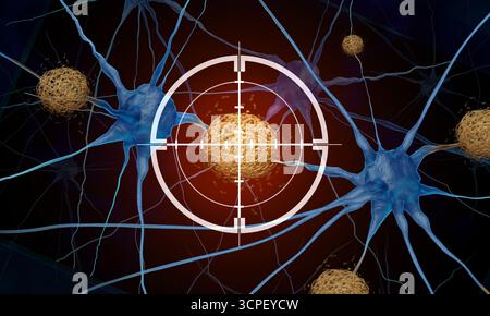 Concetto di trattamento della demenza come Tau Tangles Amyloid Beta terapia come Alzheimers medicina per rimuovere ammassi anomali di frammenti proteici che si accumulano Foto Stock