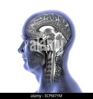 Immagine di una scansione a risonanza magnetica colorata (MRI) del cervello e del collo, che mostra l'anatomia del sistema nervoso centrale e la colonna cervicale. Foto Stock