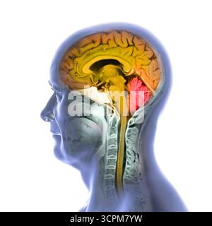 Immagine di una scansione a risonanza magnetica colorata (MRI) del cervello e del collo, che mostra l'anatomia del sistema nervoso centrale e la colonna cervicale. Foto Stock