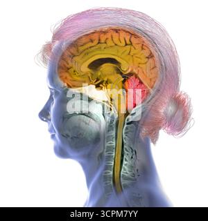 Immagine di una scansione a risonanza magnetica colorata (MRI) del cervello e del collo, che mostra l'anatomia del sistema nervoso centrale e la colonna cervicale. Foto Stock